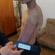 Фото из интернета. Следы от побоев